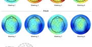 MSFT BrainScans graphic